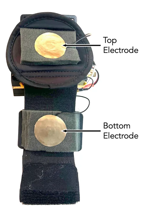 The underside of the band: two metal electrodes rest on the skin and send a tiny, harmless radio signal through the wrist and hand.